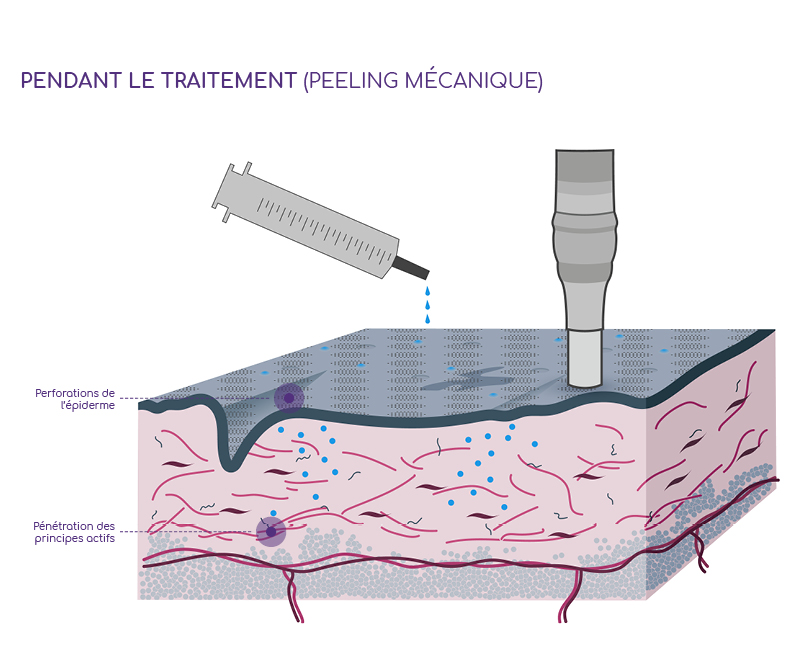 Image illustrative