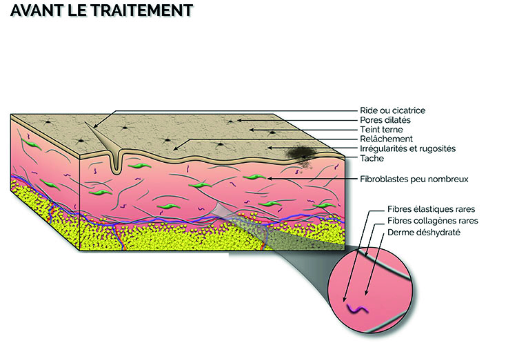 Image illustrative