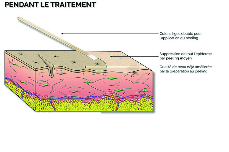 Image illustrative