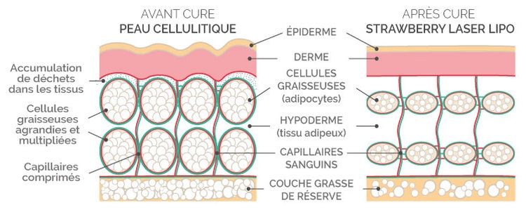 Illustratieve afbeelding