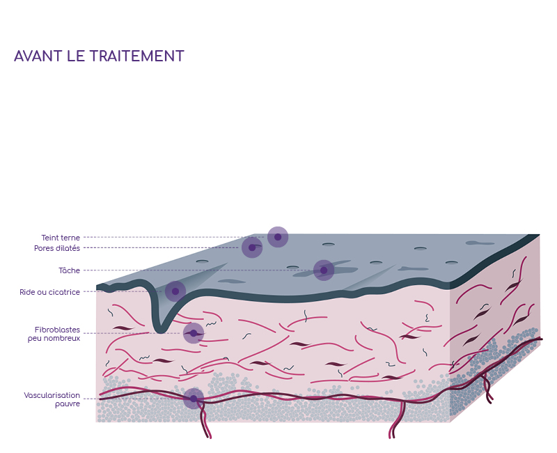 Image illustrative