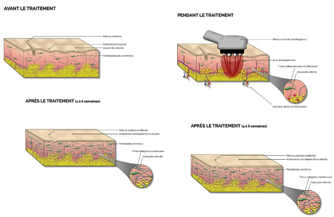 Illustrative Image